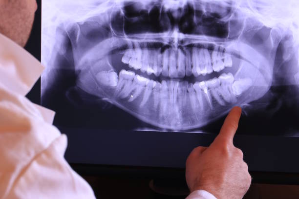 Best Emergency Care for Gum Disease in Waterman, IL