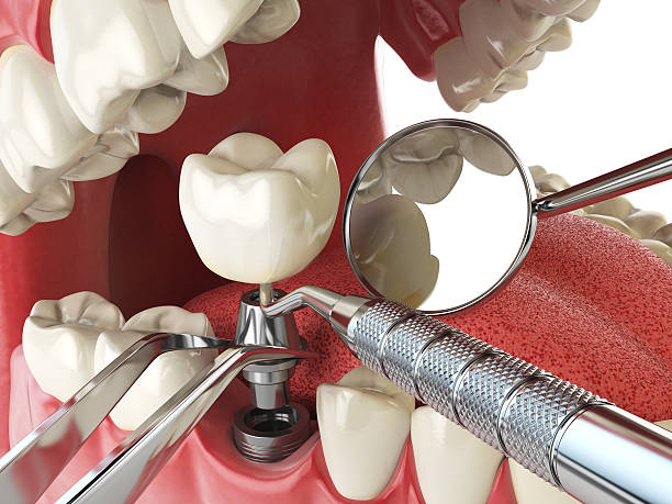 Best Emergency Treatment for Oral Infections in Waterman, IL